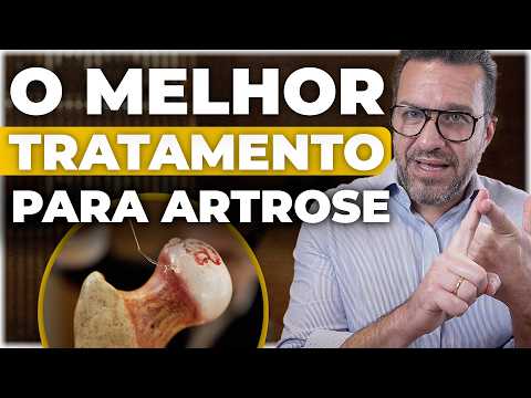 O que é MELHOR PARA ARTROSE: Ácido Hialurônico ou Hidrogel Bioativo? | quadril e joelho