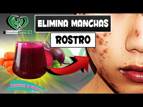 Elimina acne y manchas del rostro! Desintoxica tu organismo con este batido depurativo