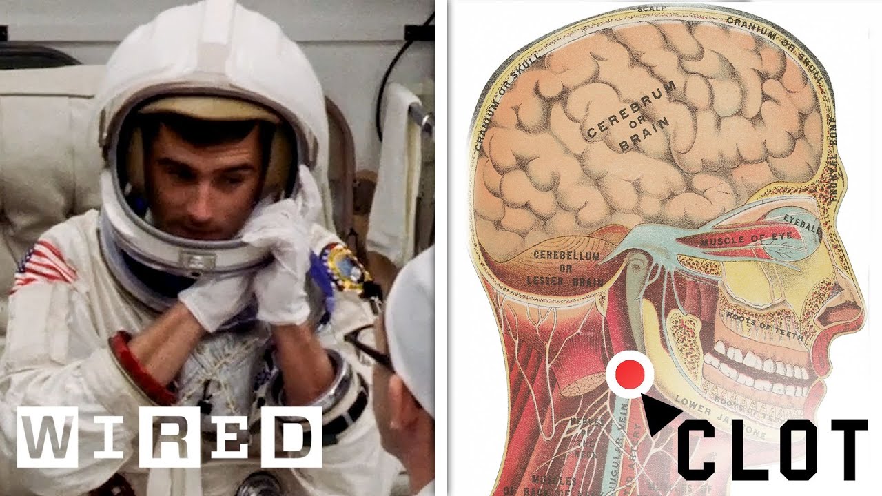 NASA Flight Surgeon Explains How to Treat a Blood Clot in Space