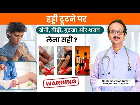 हड्डी टूटने पर अल्कोहल, बीड़ी, खैनी का सेवन सही है या गलत? | Dr. Rameshwar Kumar की सलाह