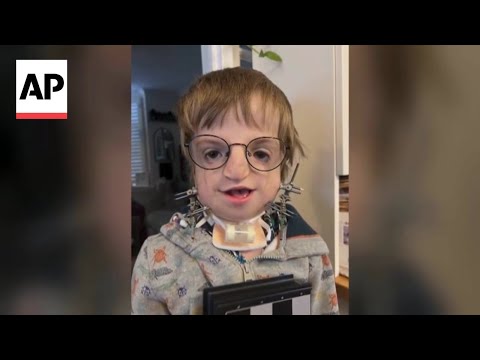 YouTube video thumbnail: Surgeons Rebuild 7-Year-Old Boy's Jaw Using His Own Ribs