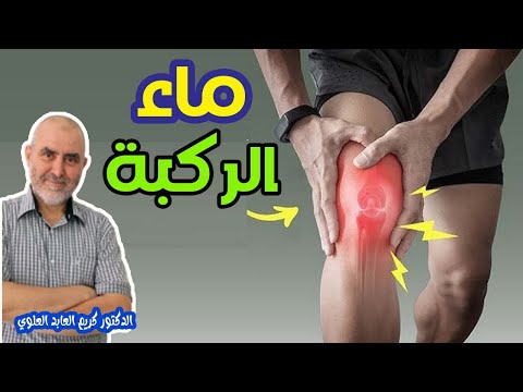 ماء في الركبة أو  إرتشاح الركبة   -  الدكتور كريم العابد العلوي  -