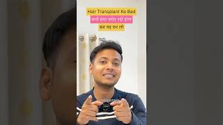 Hair Fall Kaise Control Karen / Transplant Hair Ko Jhadane Se Kaise Bachayen #shorts #hairfall