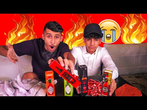 تحدي احر شطات بالعالم 🔥🌶 - على المستشفى 😂😭