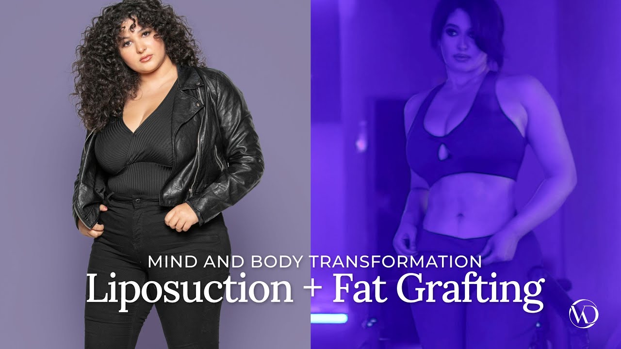 Before and after body transformation photo.