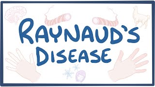 Raynaud Phenomenon - causes, symptoms, diagnosis, treatment, pathology
