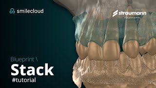 Blueprint - Stack