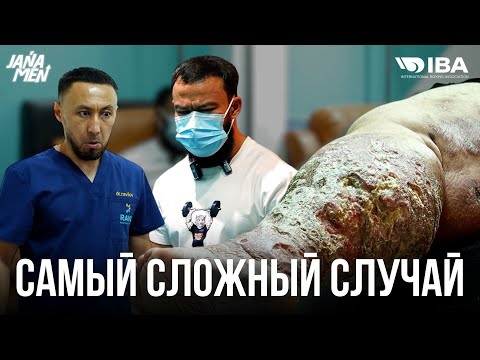 ВСЯ НОГА ГНИЕТ | ИСТОРИЯ КОТОРАЯ ТРОНУЛА ВСЕХ | АЙТЫМ ПОМОГИ МНЕ 