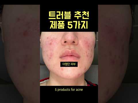 이제 이거 없으면 불안 트러블템 5가지(광고❌)