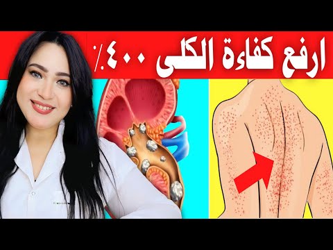 أحذر. 10 علامات غريبة تدل على تلف وموت الكلى | أقوى طعام لعكس تلف الكلى وازالة السموم ومنع فشل الكلى