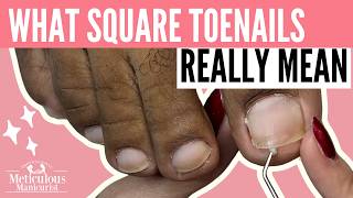 Why No Square Toenails & Diabetic Foot Care | Real Talk, Real Results, Real Transformation