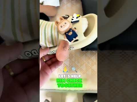 Fake Toe Prank Gone Wild! 🦶😜  Sock Check Surprise!  LIKE to Join the Fun! ❤️#funny #pranks