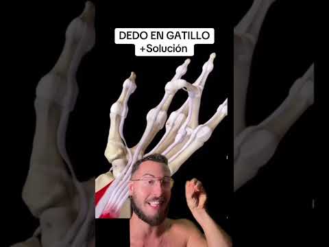 Te cuento la solución al Dedo en Gatillo en 2 minutos