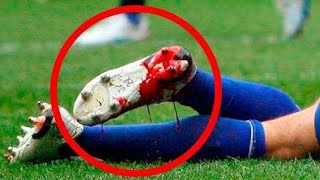 18 terribles lesiones del fútbol Blessures daños le foot