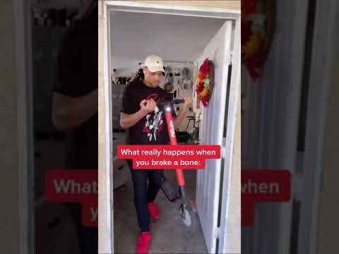 What really happens when you break a bone
