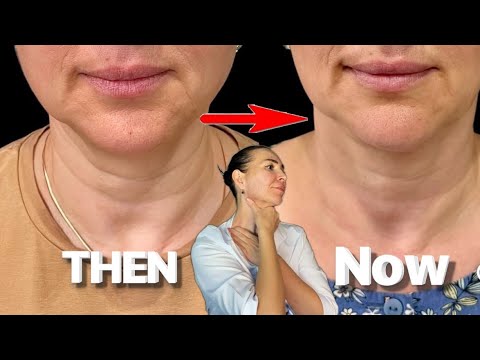 7 powerful techniques for sagging neck skin