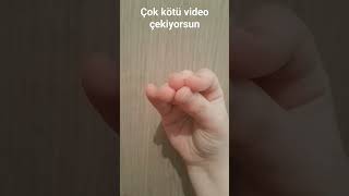 ne dedin sen😡