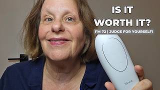 My Honest Review After Using the MimiSilk Iris Fractional Laser Device