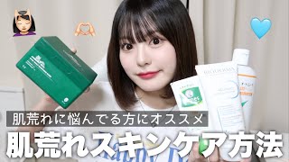 【肌荒れ】最近肌荒れてたけど治したスキンケア方法紹介しちゃうよ🧴💖
