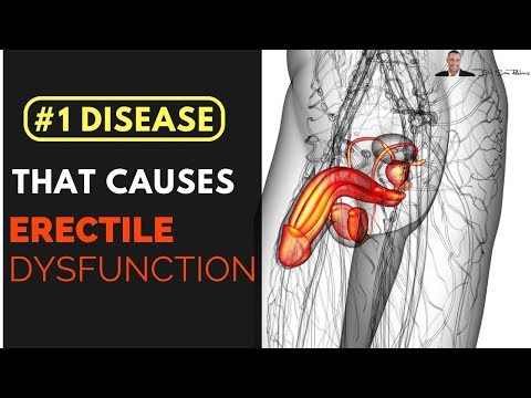 🤦‍♂️ #1 Disease That Causes Erectile Dysfunction (ED) and Impotence - by Dr Sam Robbins