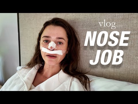 I Got A Nose Job | My Rhinoplasty Experience