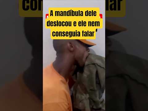 LUXAÇÃO DE MANDÍBULA: O Que É, Sintomas e Como Tratar #shorts #viralbrasil #short
