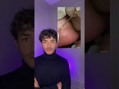 😱🚨 TU LES ENLÈVES TOI MEME ??