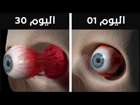 ماذا لو امتنعت عن رمش عينك لمدة 30 يوما !!