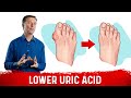 Uric Acid and Gout Management