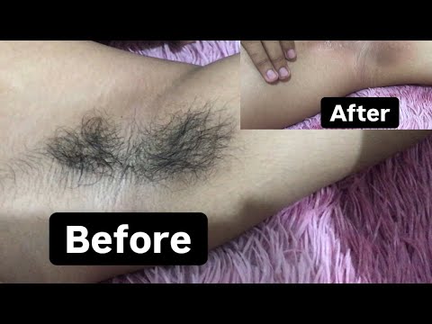 Cara Waxing Ketiak