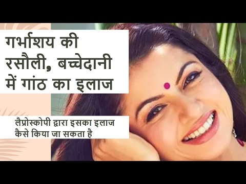 गर्भाशय की रसौली, बच्चेदानी में गांठ होने के लक्षण, कारण, इलाज व बचाव