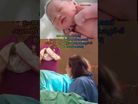 പുറത്തോട്ട് വന്നപ്പോൾ അതുകൂടി കൈയ്യിൽ കൊണ്ട് പോന്നു😂😂#youtubeshorts #funny #pregnancy #postpartum