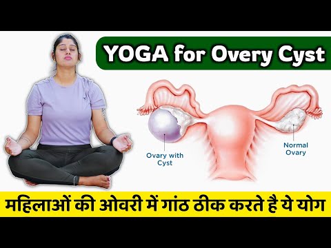Ovary Cyst ke Liye Best Yoga | महिलाओं की ओवरी की गांठ मिटाएं बिना दवा