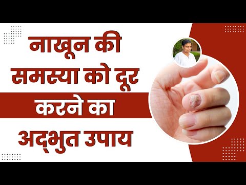 नाखून की समस्या (Nail Problems) को दूर करने का अद्भुत उपाय || Acharya Balkrishna