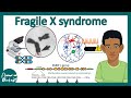 Fragile X Syndrome Concepts Assessment