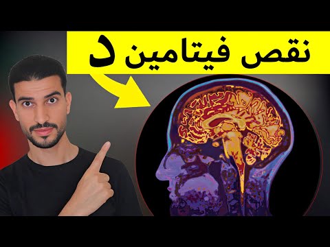 11 علامة لنقص فيتامين دال يمكنك رؤيتها !