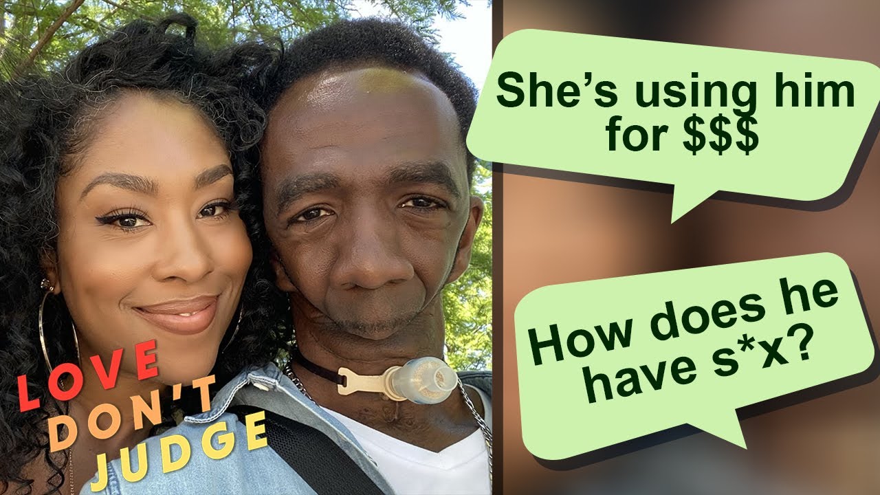 My husband has no jaw - but why troll us? - love don't judge