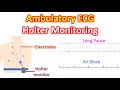 Holter Monitor and ECG Concepts