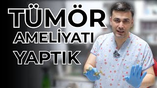 16 Yaşındaki Köpeğe Tümör Ameliyatı Yaptık!