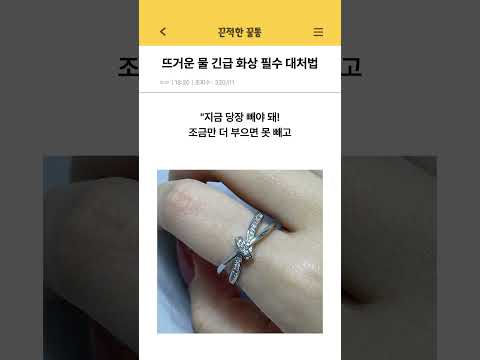 뜨거운 물 긴급 화상 필수 대처법