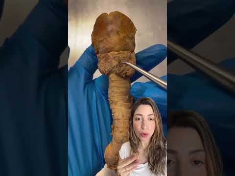 Glândula tireoide!