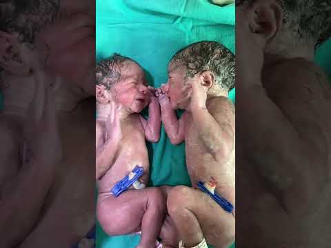 Twin babies playing with each other |#twinbabies #love #cutebabies #shortsvideo #drpoonammaggo