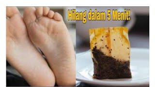 CARA MENGHILANGKAN BAU PADA KAKI& MENGHILANGKAN DAKI/SEL KULIT MATI. 
