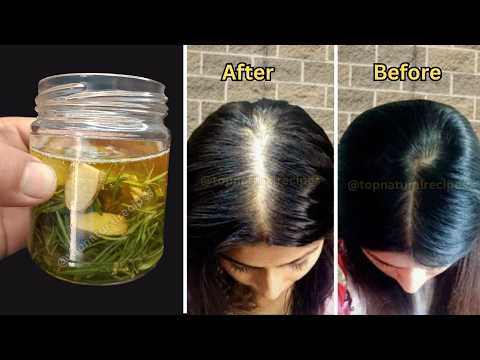 How to Make Rosemary and Ginger Oil for Hair Growth | Stop Hair Fall & Regrow Thinning Hair