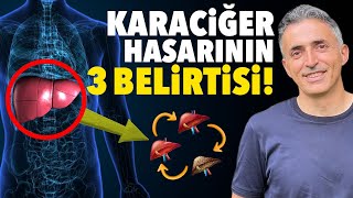 Eğer Büyük Tuvaletinizde Bu Renkler Varsa DİKKAT!  KARACİĞERİNİZ TEHLİKEDE OLABİLİR! | Doktor Fitt