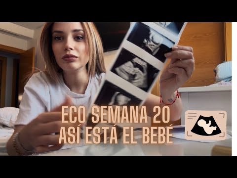 "Semana 20 de embarazo: Ecografía importante ⚠️”