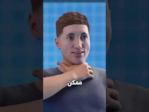 ايش تعمل لو اختنقت من الاكل 🍔
