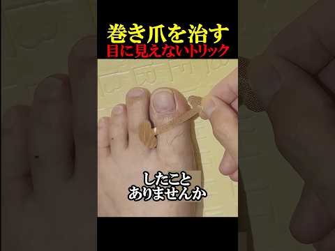 巻き爪から守る方法