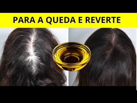 MISTRE NO SHAMPOO, NASCE CABELO ATÉ NA TESTA E PARA DE QUEBRAR