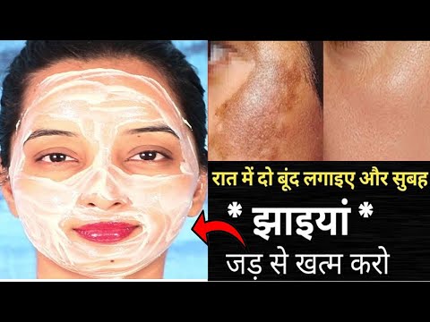 कितने भी पुराने ACNE, SCARS, PIGMENTATION, DARK CIRCLE होंगे जड़ से खत्म - 100% ग्लो आयेगा Skin Care